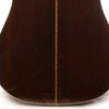 Martin 1959 D-28 Dreadnought Acoustic Guitar - lower bout