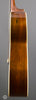 Martin Acoustic Guitars - 1937 000-28 - Sunburst- Side2