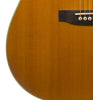 Martin D-35 ding front detail